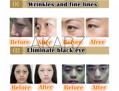 AKARZ  Natural Beautify eyes essential oil Relieve tired eyes and dark circles fade wrinkles eye care massage oil